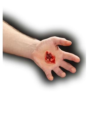 Blessure par balle de gros calibre