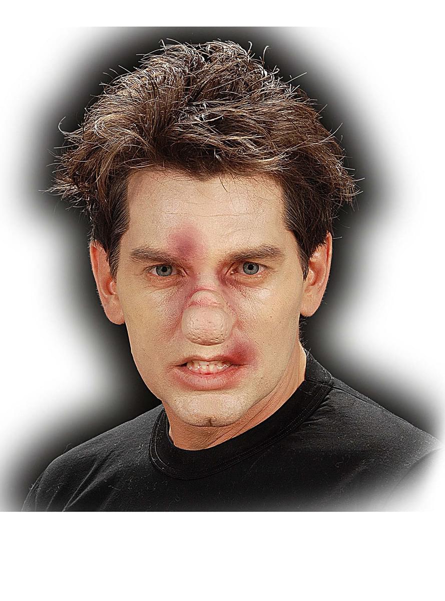 Broken Nose