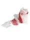 Durchbluteter Verband