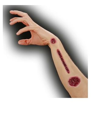 Set de heridas infectadas