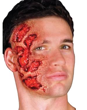 Prothèse latex brûlure infectée