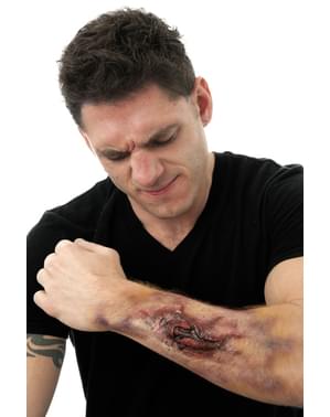 Prótese em látex braço fratura interna