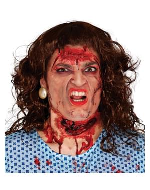 Cicatrice gât tăiat