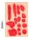 Infected Wound Set