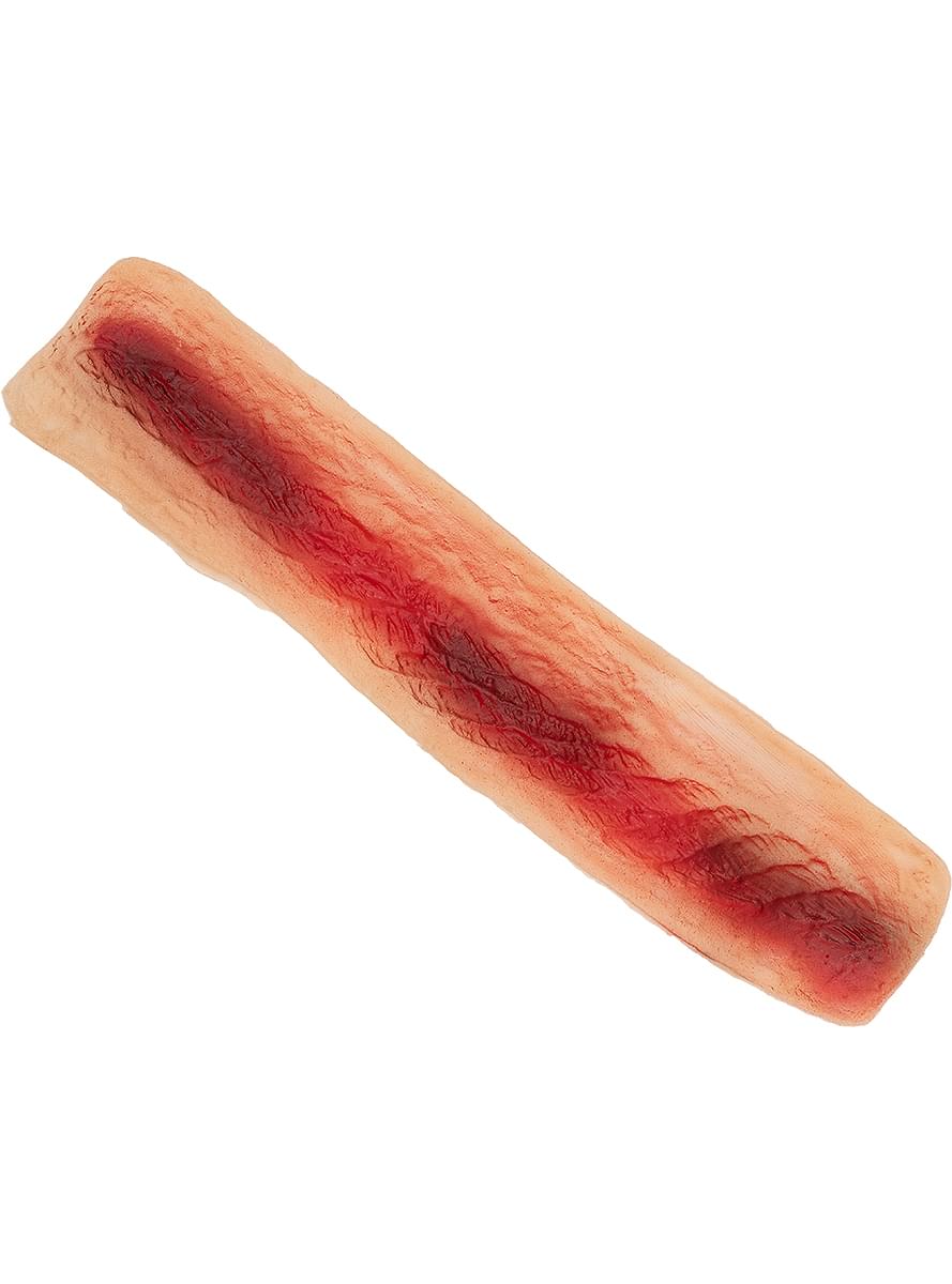Ανοιχτή πληγή
