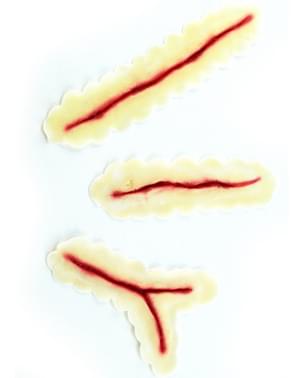 Latex prothese lichte littekens