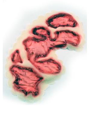 Protesi in lattice bruciatura infetta